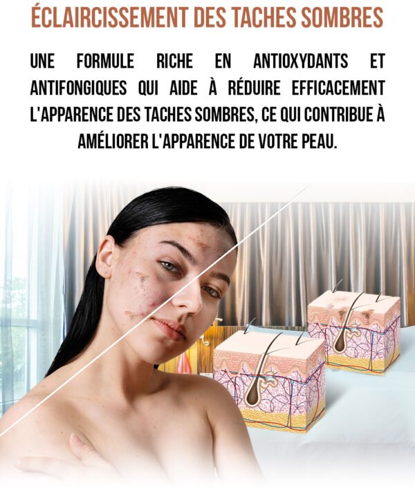 Crème anti-âge, éliminant les rides – Image 4